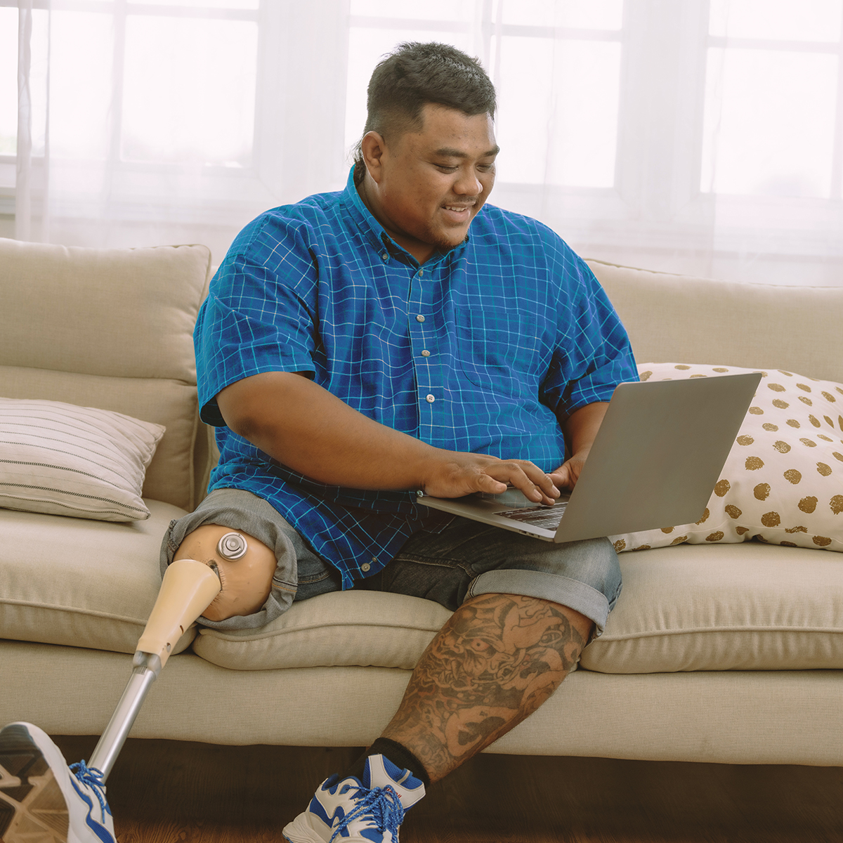 A man sits on a couch with his laptop and we can see his prosthetic leg